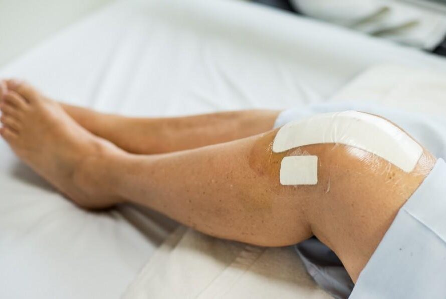 Essential Do’s and Don’ts for Recovery after Knee Replacement Surgery