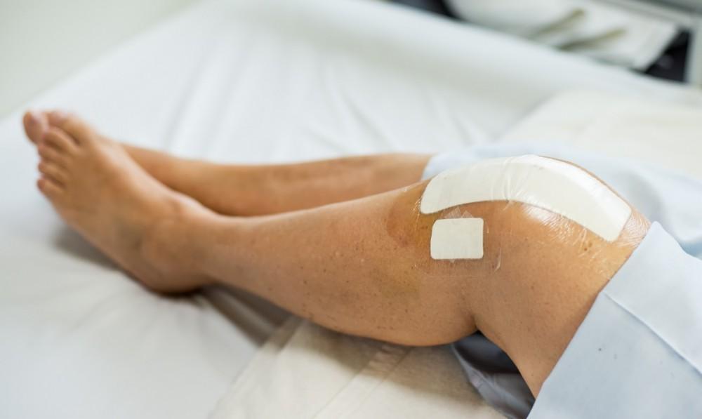 Essential Do’s and Don’ts for Recovery after Knee Replacement Surgery