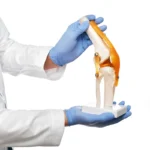How to Prepare for Total Knee Replacement Surgery