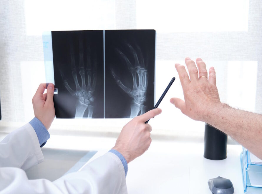 When to Visit an Orthopedic Surgeon for Arthritis