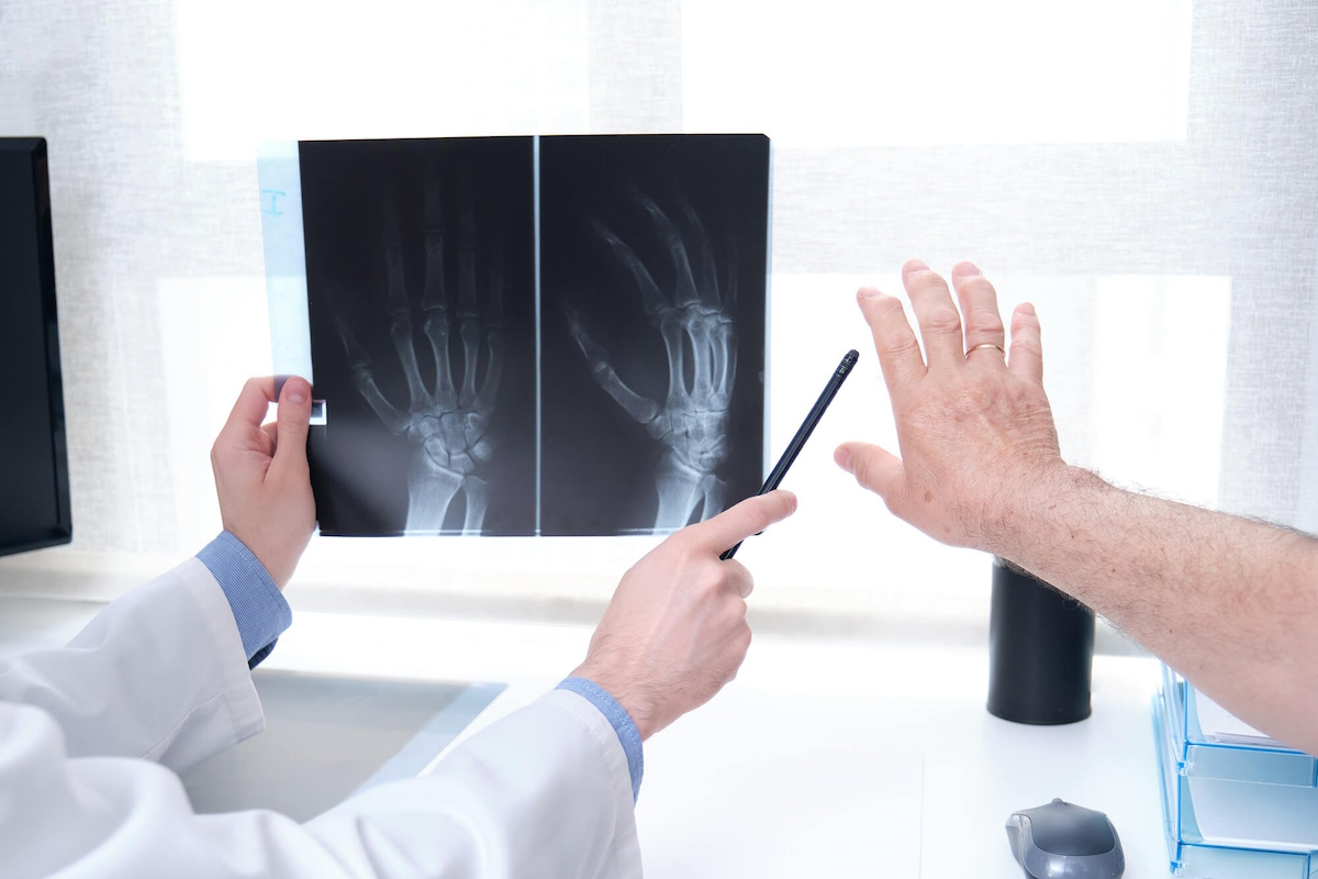 When to Visit an Orthopedic Surgeon for Arthritis