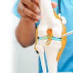Best Knee Replacement Surgeon in Ahmedabad