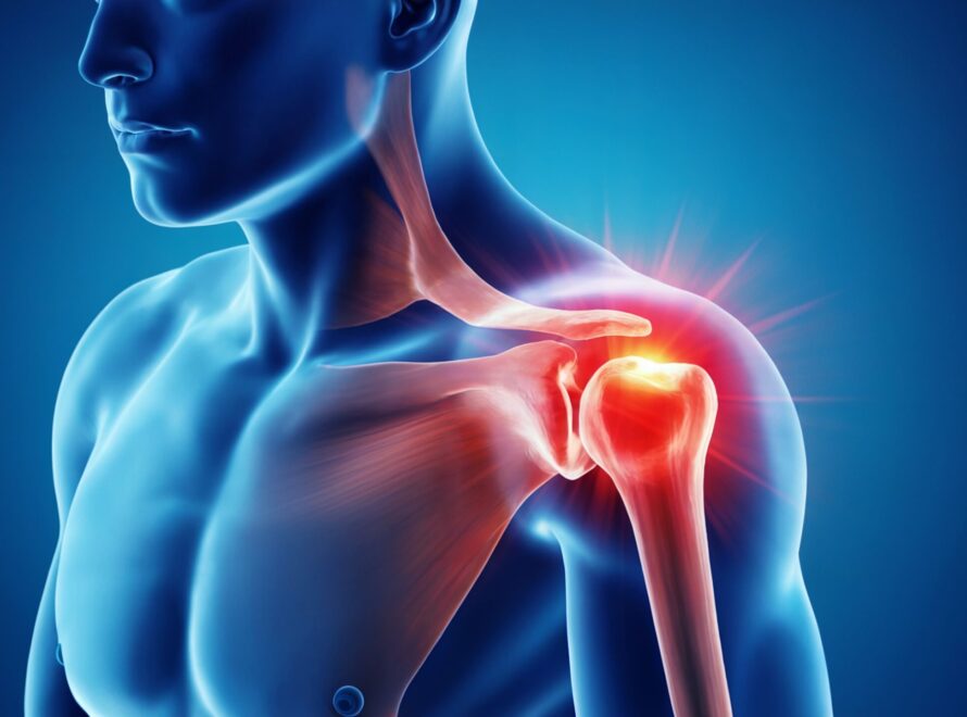 Best Orthopedic Treatment for Rotator Cuff Injury in Ahmedabad