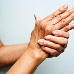 What Are the Best Arthritis Treatment and Surgery Options in Ahmedabad